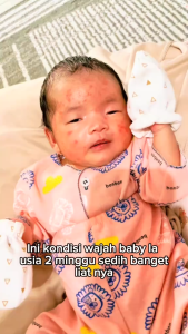 EXPERT CARE Daily prOATect Sunscreen / Soothing / Calming Cream - Krim Khusus Anak dan Bayi