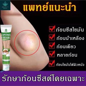 แท้💯OUHOE Lymph Care Ointment สมุนไพรสลาย ก้อนใต้ผิวหนัง ก้อนซีสต์ ก้อนไขมัน ครีมทาซีส ก้อนไขมัน ครีมระบายน้ำเหลือง ส่งด่วน ส่งฟรี