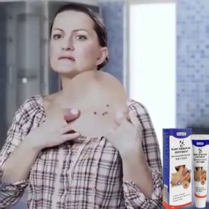 100% Natural Wart Removal Ointment Body Warts Treatment Cream Skin Tag Remover Blemish Buang Tahi Lalat Ketuat Kutil 20g
