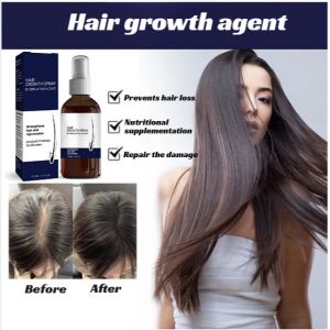 Anti Hair Loss Hair Growth Solution Essence Rapid Growth Hair Enhancer Hair Densifier for Men and Women Hair Growth Hairline防脱育发喷雾