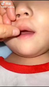 MY Girl Buy 1 Take 1 Baby Toothbrush U-Shape Toothbrush Kids Mousse Foam Toothpaste Set Teeth Clean\\n\\n What is MY Girl Buy 1 Take 1 Teeth Cleaning Set?\\n\\nThe MY Girl Buy 1 Take 1 Teeth Cleaning Set is a specially designed oral care package for children, consisting of a baby toothbrush with a unique U-shape design and a kids mousse foam toothpaste. This set aims to make brushing teeth a fun and engaging experience for kids, promoting good oral hygiene habits from an early age.\\n\\n Key Features of MY Girl Teeth Cleaning Set\\n\\n- U-shape baby toothbrush: The toothbrush has a curved design that fits perfectly around the child's teeth, making it easier for them to brush their teeth effectively.\\n- Kids mousse foam toothpaste: The toothpaste is formulated with gentle ingredients, specifically designed for children's sensitive teeth and gums.\\n- Buy 1 Take 1 Offer: With every purchase of the MY Girl Teeth Cleaning Set, you'll receive a second set at no extra cost.\\n\\n How to Purchase MY Girl Buy 1 Take 1 Offer\\n\\nTo take advantage of the Buy 1 Take 1 offer, simply visit the MY Girl website or authorized retailers, add the Teeth Cleaning Set to your cart, and proceed to checkout. Once your order is confirmed, you'll receive both sets at the price of one.\\n\\n Benefits of Using MY Girl Baby Toothbrush U-Shape\\n\\nThe U-shape design of the MY Girl baby toothbrush offers several advantages for children's oral health.\\n\\n Why Choose U-Shape Design for Your Child's Oral Health\\n\\n- Easy to handle: The curved shape makes it easier for children to hold and maneuver the toothbrush, even if they have limited dexterity.\\n- Better reach: The U-shape design allows the toothbrush to reach hard-to-reach areas, ensuring thorough cleaning of the child's teeth.\\n- Comfortable grip: The ergonomic handle provides a comfortable grip for children, reducing the risk of slipping during brushing.\\n\\n How to Properly Use MY Girl Baby Toothbrush U-Shape\\n\\nTo get the most out of the MY Girl baby toothbrush U-shape, follow these steps:\\n\\n1. Wet the toothbrush bristles with water.\\n2. Apply a small amount of kids mousse foam toothpaste onto the bristles.\\n3. Gently brush the child's teeth in circular motions, paying special attention to the chewing surfaces and hard-to-reach areas.\\n4. Rinse the child's mouth with water after brushing.\\n\\n Understanding MY Girl Kids Mousse Foam Toothpaste\\n\\nMY Girl Kids Mousse Foam Toothpaste is specifically formulated for children's sensitive teeth and gums, providing gentle yet effective cleaning.\\n\\n Key Ingredients & Benefits of MY Girl Kids Mousse Foam Toothpaste\\n\\n- Fluoride: Helps prevent cavities and strengthens tooth enamel.\\n- Natural flavors: The toothpaste comes in various kid-friendly flavors, making brushing a fun experience.\\n- Gentle formula: The toothpaste is free from harsh chemicals, ensuring a safe and gentle brushing experience for children.\\n\\n How to Apply MY Girl Kids Mousse Foam Toothpaste\\n\\nTo apply the toothpaste effectively:\\n\\n1. Squeeze a small amount of toothpaste onto the bristles of the MY Girl baby toothbrush U-shape.\\n2. Encourage the child to brush their teeth in circular motions, focusing on all surfaces of the teeth.\\n3. Remind the child to spit out the toothpaste after brushing, rather than swallowing it.\\n\\n Tips for Maintaining Good Oral Hygiene for Kids\\n\\nEstablishing good oral hygiene habits early on is crucial for maintaining healthy teeth and gums throughout a child's life.\\n\\n Importance of Early Oral Care Habits\\n\\n- Prevent cavities: Regular brushing and flossing help remove food particles and plaque, reducing the risk of cavities.\\n- Promote healthy development: Good oral hygiene habits contribute to the proper development of permanent teeth.\\n- Build confidence: A healthy smile boosts a child's self-esteem and confidence.\\n\\n Creating a Fun & Engaging Oral Care Routine\\n\\nTo make brushing teeth a fun experience for kids:\\n\\n- Sing songs or play games while brushing teeth.\\n- Use kid-friendly toothbrushes and toothpaste flavors.\\n- Reward good oral hygiene habits with stickers or small prizes.\\n- Lead by example: Show your child how to brush their teeth properly by doing it together.\\n\\nBy following these tips and using the MY Girl Buy 1 Take 1 Teeth Cleaning Set, you can help your child develop good oral hygiene habits that will last a lifetime.\"