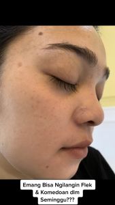 JGLOW Skincare PAKET FLEK PREMIUM Cream Glowing Perawatan Wajah Untuk Flek Membandel & Bekas Jerawat AMAN UNTUK BUMIL DAN BUSUI