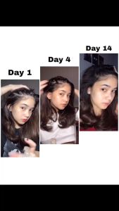 Scalp Treatment Tonic - Vegan & Water- based hair Tonic for Massive Hair Growth