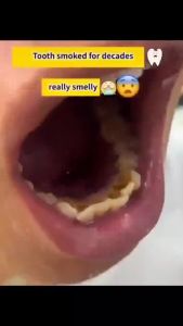 Pasta Gigi Pemutih Gigi Kuning & Penghilang Karang Gigi 200g Probiotik Whitening Toothpaste