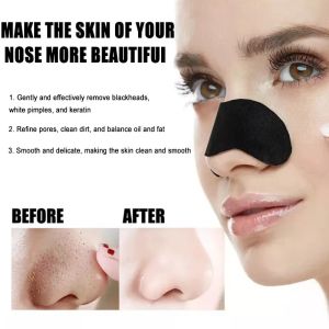 10pc/25pc/50pc/100pc Nose Cleansing Blackhead Pore Remover Patch - Deep Cleansing Pores Gentle Exfoliation for Facial Care