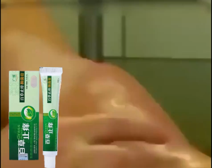 【ซื้อ 1 แถม 1】 GRASS ITCHING ครีมคัน【40g】 ไม่เด้งกลับ สูตพืช ซ่อมแซมผิวเสียหาย สารสกัดจากพืชใช้ได้ทั้งตัว บอกลาผิวคันได้ง่ายๆ