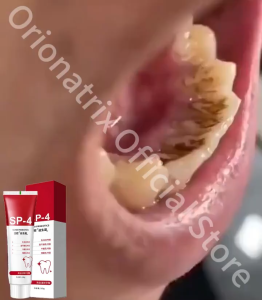 KUCHIDA Tooth Paste Probiotik SIP-4 Pasta Gigi Pemutih Gigi Karang Gigi VP084