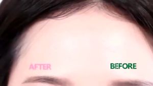 【BUY 1 TAKE 1】240PCS Pimple Patch Repair Acne Clean Pores Skin Care Waterproof Acne Treatment Concealer Patches