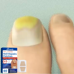 【BUY 1 TAKE 1】Ximonth    Nail Fungus Treatment Patch Onychomycosis Repair Sticker Remove Nail Thickening Discoloration Restore Healthy Nails For Toenail Fingernail  60 Patches