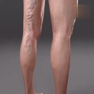 【HSA Certification】8 Intravenous Health Patches/Box | Natural Herbal Formula | Relieve leg soreness and pain | Improve varicose veins | Special for sitting for a long time