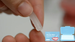 Wax Splint Nha Khoa Oralhoe - Dùng để tạo hình răng lấp đầy khoảng trống giữa các răng chỉnh nẹp răng và tăng tính thẩm mỹ cho nụ cười. Phù hợp cho việc chăm sóc răng miệng.