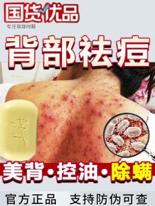 Shanghai Sulfur Soap Bathing Scrubbing Antibacterialitch ReliefFungus And Acne RemovalFor MenRegular SizeBasic Packaging
