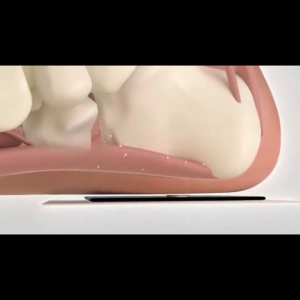 Sakaeda Yexun heel pain patch for heel pain heel bone spurs chapped fascia tears pain bruises sprains and swelling