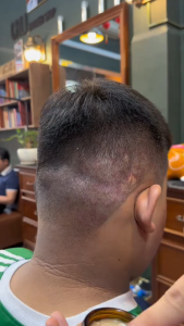 Kem Nấm Da Đầu Làm Sạch Gàu Nấm Với Thiết Kế Dạng Hũ Tròn Dung Tích 20G Phù Hợp Dành Cho Tất Cả Mọi Người Dễ Dàng Sử Dụng