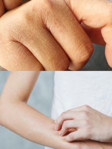 DMelza Body Serum 100ml (BPOM)