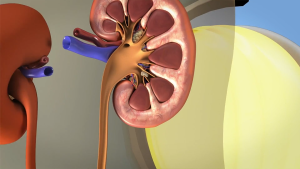 Neysure Gold Colostrum Milk For Kidney Support Kidney Failure Prevent Kidney Stone Supplements With Increased Blood Urea