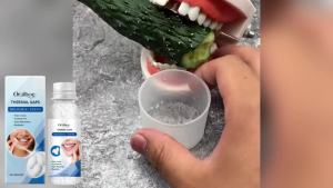 oralhoe | Thermoplastic Denture Adhesive Temporary Tooth Repair Kit Moldable Teeth and Gaps False Teeth Solid Glue Dental Filling Material