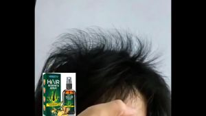 Essensi Perawatan Rambut 30ml: Penumbuh Rambut Cepat & Sehat