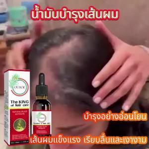 OUHOE น้ำมันหอมระเหยดูแลเส้นผม การนวดให้ความชุ่มชื้นอย่างอ่อนโยนสำหรับหนังศีรษะน้ำมันหอมระเหยสำหรับผมที่แข็งแรงและอ่อนนุ่ม