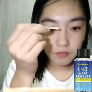 Warts Removal Warts Remover Ointment Serum 30ml Kasoy Oil Warts Remover Original Mole Remover Kulogo Buni Removal Effectively Remove Common Warts Flat Warts Filamentous Warts and Sharp Warts
