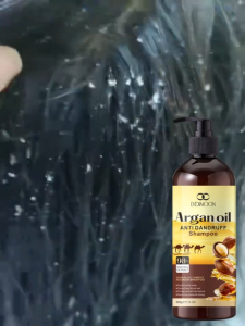 Anti Ketombe Shampo Anti Gatal Mite Removal Kontrol Minyak Mencegah Berminyak Rambut Rontok Pembersihan Lembut Kulit Kepala Berkerak Gatal Shampo Rontok Dan Ketombe Obat Ketombe Rambut Pengobatan Folikulitis - 500ml