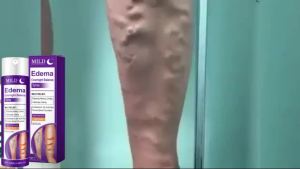 Varicose veins Spray for Legs with Glycerin Panthenol Relieve Tightness Dryness Lightweight Mist Soothing Overnight Comfort Skin Hydration Easy Application Non Greasy Formula Daily Body Care Routine Refreshing Feel Suitable For Hot Weather Gentle On Skin