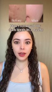 Numbuzin No.5 Vitamin Concentrated Serum 30ml: Mengatasi Kerutan Halus & Membuat Warna Kulit Merata