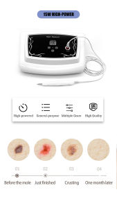 15W High-power Mole Remover Dark Spot Freckle Warts Black Spots Pimples Plasma Remover Pen For Skin Tag Removal 36 Level