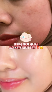 Hanasui Advance Retinol Serum - Anti Aging Serum untuk Kerutan Halus Tekstur Kulit Cerah Kenyal Encapsulated Retinol HPR Advance