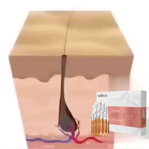 EELHOE | Hair Growth Serum Ampoules Nourish Scalp Care Strengthen Hair Roots Repair Follicles Anti-Hair Loss Promote Growth Essential Oil