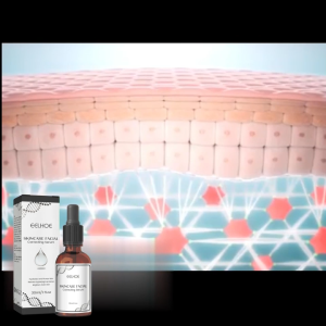 EELHOE Facial Repair Essence – Reduces Freckles เซรั่มบำรุงผิวหน้า ลดเลือนกระ ฝ้า จุดด่างดำ และเมลานิน ให้ความชุ่มชื้น และทำให้ผิวหน้ากระจ่างใส สดชื่น