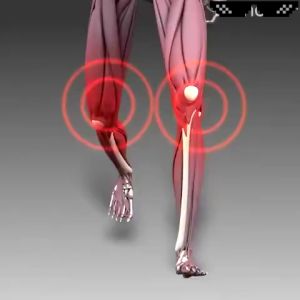 【Buy 2 Take 1】1PCS Bee Venom Treatment Gel joint and bone cream bee venom supplement treat joint knee pain toe bone pain relief of joint pain lumbar spine cervical spine musculoskeletal pain professional treatment knee shoulder Neck