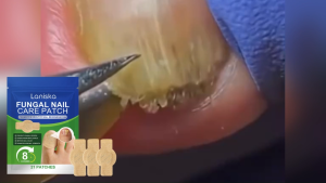 Toenail Fungus Repair Patch — Promotes Nail Regeneration  Strengthening Relieves Paronychia Cares for Damaged  Fungal Nails Corrects Ingrown Nails