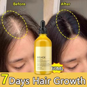 rosemary oil rambut penumbuh rambut botak pelebat rambut penumbuh rambut cepat rambut rontok dan penumbuh rambut minyak rosemary untuk rambut hair oil rosemary anti rambut rontok  Pria Dan Wanita Semua Boleh Menggunakan