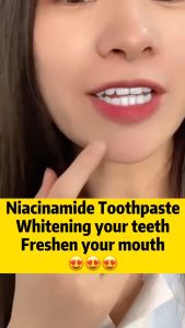 【Buy 1 Get 1 Free】Niacinamide Teeth whitening toothpaste Ubat gigi pemutih Pemutih gigi Remove tartar remove yellow teeth probiotic toothpaste oral care fresh breath remove plaque and prevent tooth decay 美白牙膏