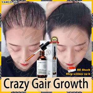 👒SG stock👒 Hair growth serum for men women / Anti hair loss serum / Ginger hair tonic / Hair fall treatment / Hair loss tonic 防脱发精油