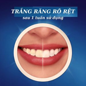 (1 GÓI 7 MIẾNG ) Miếng dán trắng răng chỉ 30 phút  5D TEETH WHITENING STIKER