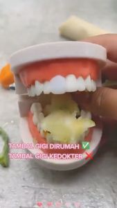 [ 2 PCS/BUNGKUS ] Super Kuat penambal gigi ompong Gigi Palsu Penutup Ompong Depan Bawah Penambal Gigi Ompong Berlubang Patah Penambal gigi renggang permanen Temptooth Temporary Tooth Asli 100% Original Aman Temptooth Bahan Gigi Palsu Ori Murah Isi Banyak