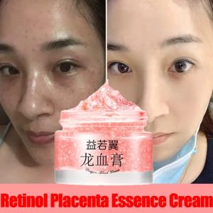 🔥🔥Roman Holiday Dragon Blood Cream Retinol Placenta Essence Dragon Blood Whitening Cream Lasting Moisturizing Brightening Skin Face Cream Repairs Skin Firm Anti-wrinkle Cream Anti Aging Cream Melasma Removal Cream