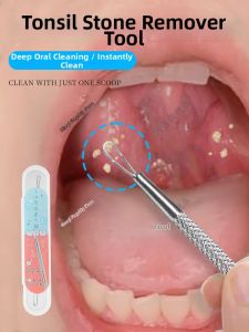 MINQI | Tonsil Stones Removal Tool