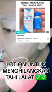 PENGHILANG TAHI LALAT DAN KUTIL SWISS PARIS LOTION
