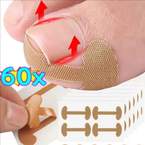 Dorisna 60Pcs Toenail Corrective Patch Nail Repair Patch Nail Ingrown Correction Sticker Toenail Care Paronychia Nail Patch
