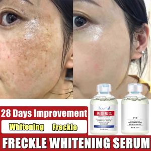 Niacinamide Anti Freckles Serum Whitening Serum Melasma Dark Spot Remover Whitening Pigmentation Remover Brighten Skin Anti-Aging 祛斑美白精华 50ML