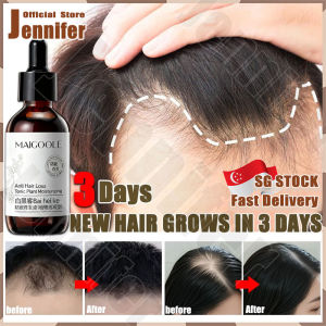 💥𝙎𝙂 𝙨𝙩𝙤𝙘𝙠💥 Hair growth serum for men women / Anti hair loss serum / Ginger hair tonic / Hair loss tonic / Hair fall treatment / 防脫發精華液