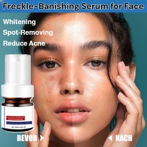 Freckle-Banishing Serum for Face Repair and Cleanse Remove Dark Spots Anti-Aging Essence Reduce Acne Whitening Moisturizing 祛斑精华