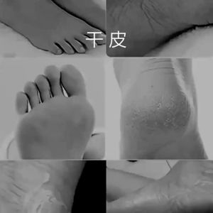 MoisturItchy Feet Lavender Exfoliating Foot Mask Foot Film Whitening