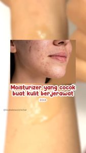 Acne Night Cream SR12 Perawatan Kulit Jerawat untuk Malam Hari