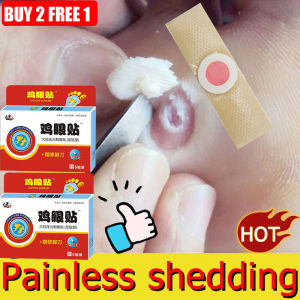 Foot corns removal patch 35g wart remover Natural herbal repair corns and callus remover Foot care Remove old thick cuticles Remove thorns 鸡眼贴 painless removal easy to use comfortable