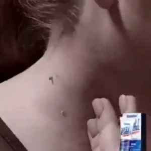 【100% Effective 】Wart Removal Cream Painless No Scars Skin Growth Wart Remover Original Wart Magic Remover Quickly Remove Skin Warts Wart Removal Essence Effectively Removes Flat Warts Filiform Warts And Condylar Warts Skin And Facial Care Ointment 20g