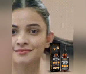 เซรั่มเร่งการงอกใหม่ของเส้นผม ลดผมร่วง กระตุ้นรากผม ให้แข็งแรง ด้วยสารสกัดสมุนไพร Vegan Formula Hair Growth Serum 30ml